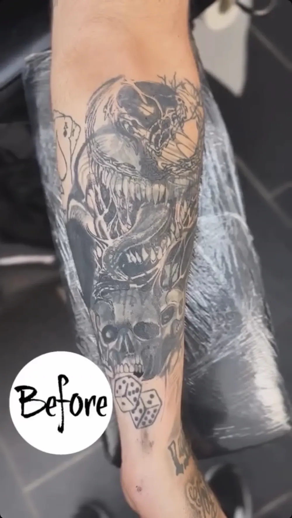 Unterarm vor dem Cover-up